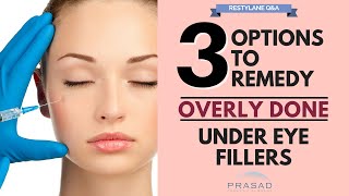 Options to Remove Excess Filler Placement and Treatments to Improve Under Eye Area [upl. by Cesaro529]