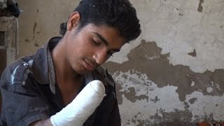 Syrian teenagers amputated hand a legacy of IS rule [upl. by Enrol365]