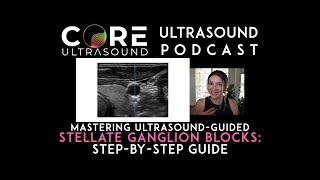 Mastering UltrasoundGuided Stellate Ganglion Blocks StepbyStep Guide [upl. by Eimot]