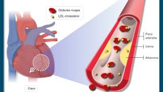 Questce que lathérosclérose [upl. by Bohlen]