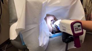 Colposcopy training video [upl. by Yclehc]