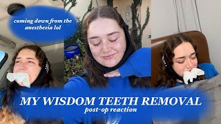 my wisdom teeth removal reaction  coming down from the anesthesia funny [upl. by Anytsyrk592]