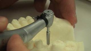 Dental implant surgery training video [upl. by Nogras679]