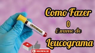 COMO FAZER O EXAME DE LEUCOGRAMA [upl. by Aleibarg536]