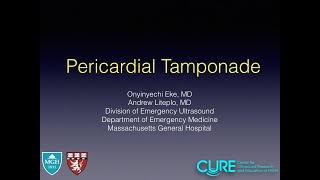 Pericardial Tamponade [upl. by Reppart]