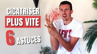 6 ASTUCES POUR CICATRISER PLUS VITE  🩹 [upl. by Adnilec]