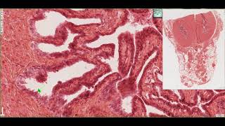 Histology of the Seminal Vesicles 4K [upl. by Jerold136]