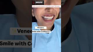 Fluorosis Stained Teeth Treated with Porcelain Veneers shorts cosmeticdentistry dentist yt [upl. by Ydeh]