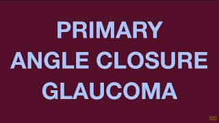 Glaucoma Session 14 Primary Angle Closure Glaucoma [upl. by Alimac535]