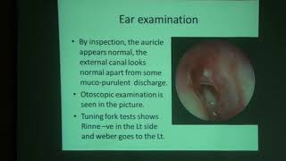 Case Scenario CSOM  ENT  4th grade  by Dr Hamza Elshafiey Ahmed [upl. by Atniuq776]