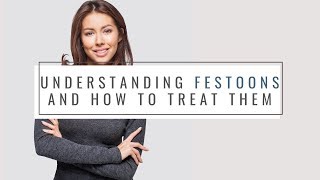 Understanding Festoons and How They Can Be Treated  Verso Surgery Centre [upl. by Yurt78]