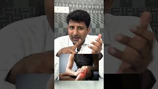 How to treat swelling after injury  Dr Jeya Venkatesh [upl. by Atarman52]