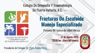 Fracturas De Escafoides Manejo Especializado [upl. by Poliard700]