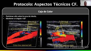 Doppler Arterias Carótidas y Vertebrales  Dr Daniel Sandoval Guerra [upl. by Onimod]