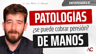 Patologías de manos y muñecas Criterios para Incapacidad Permanente [upl. by Sullecram]