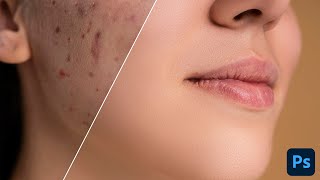 How to RETOUCH SKIN like a PRO in Photoshop  Easy Tips [upl. by Corbett]