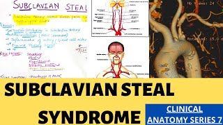 SUBCLAVIAN STEAL SYNDROME  Clincal anatomy series 7  Suyash shukla [upl. by Ainek]