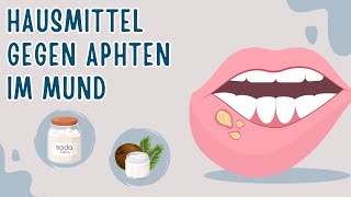 10 Natürliche Hausmittel gegen Aphten im Mund [upl. by Yromem86]