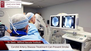 Carotid Artery Surgery New Haven CT For Stroke Prevention With The Best Vascular Surgeons in Milford [upl. by Reitman]