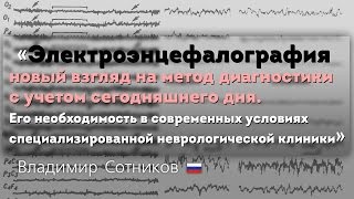 ЭЭГ Её необходимость в современных условиях специализированной неврологической клиники [upl. by Britni]