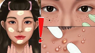 ASMR Multiple Milia Extraction Animation Whitehead Removal Facial Mole Wonyoung Makeup [upl. by Opportina956]