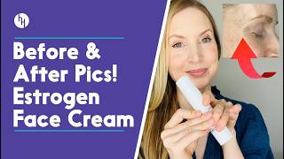 I Used An Estrogen Face Cream For 3 Months  Alloy M4 Review [upl. by Mik]