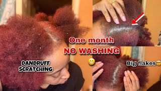 DANDRUFF SCRAPING Removal 😬  One month NO WASHING 😩  Hair Journey 💆🏽‍♀️ [upl. by Reidid712]