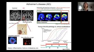 UW Pathology Presents  Dr Oksana Berezovska [upl. by Aerdnac884]