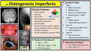 Osteogenesis imperfecta clinical features diagnosis and management [upl. by Aicilanna]