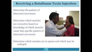 Part 7  Treatment of Cervical Dystonia [upl. by Asetal]