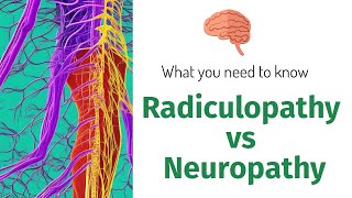 The Difference Between Radiculopathy And Neuropathy  What You Need To Know [upl. by Sissie]