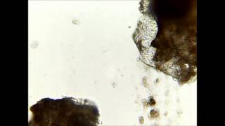 Demodex  killing in seconds with ethanol [upl. by Ortensia279]