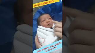 Cute newborn baby next to parents for the first time after birth 😍 viralbaby [upl. by Ahtrim]