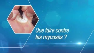 Le pied diabétique conseils pratiques par la Dr Aouiche [upl. by Eaton]