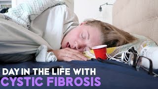 DAY IN THE LIFE WITH CYSTIC FIBROSIS  COUGHING EXERCISE FEVER amp FEEDING TUBE 8217 [upl. by Nek]