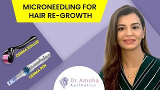 Microneedling for Hair Loss  Does It Works  डर्मा रोलर से बाल उगने के फायदे  Dr Amoha Bhatia [upl. by Stormie]