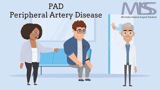 All You Should Know About Peripheral Artery DiseasePAD  MISS  San Jose [upl. by Wira]