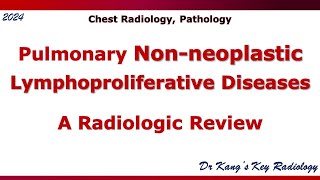 Pulmonary Nonneoplastic lymphoproliferative disease LPD [upl. by Terra]