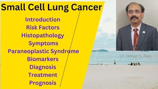 Small Cell Lung Cancer [upl. by Pawsner]