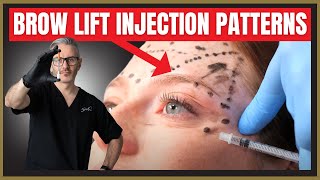 Botox Brow Lift Injection Patterns Botox MarkUp Tutorial [upl. by Hoenack]