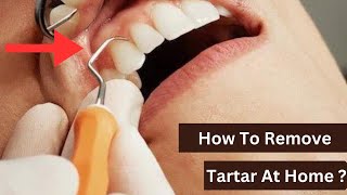 Is it Possible To Remove Tartar At Home [upl. by Alleyn]