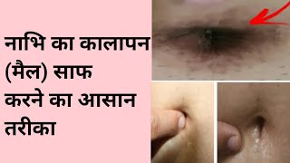 नाभि का कालापन मैल साफ करने का आसान तरीकाHow To Clean Your Belly ButtonNavel [upl. by Oigres683]