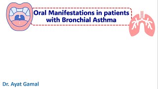 Oral manifestations of bronchial asthma amp medication modifications [upl. by Parthinia]