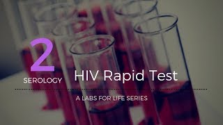 HIV Rapid Test [upl. by Cand281]