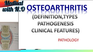 OSTEOARTHRITIS IN HINDI DEFINITION TYPES PATHOGENESIS CLINICAL FEATURES ETC [upl. by Benco]