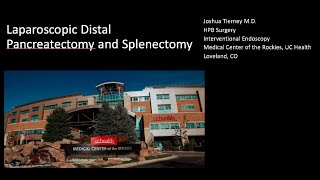 Laparoscopic distal pancreatectomy with splenectomy [upl. by Ahouh]