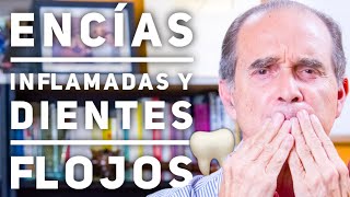 Episodio 1900 Encías Inflamadas Y Dientes Flojos [upl. by Firahs]