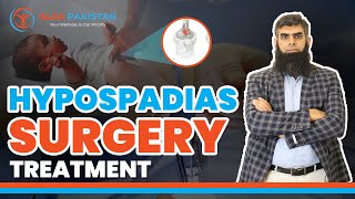 Treatment Strategy of Hypospadias Surgery in Boys  Hypospadias Boys  Alsa Pakistan [upl. by Lleinnad]