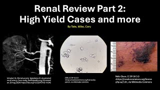 Medicine Shelf Review Renal Review Part 2 [upl. by Gurney662]