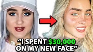 I was UGLY Before Spending 30000 on a NEW FACE  Surgeon Reacts [upl. by Eiliak633]